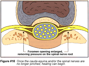 Figure 10: Healing